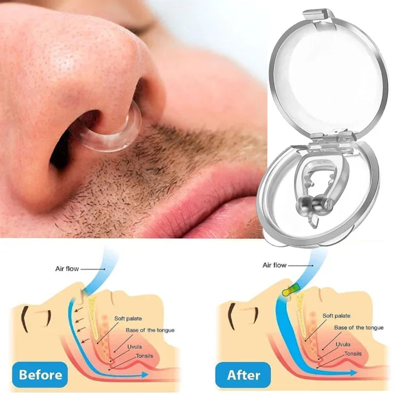 Anti-Snoring Corrector